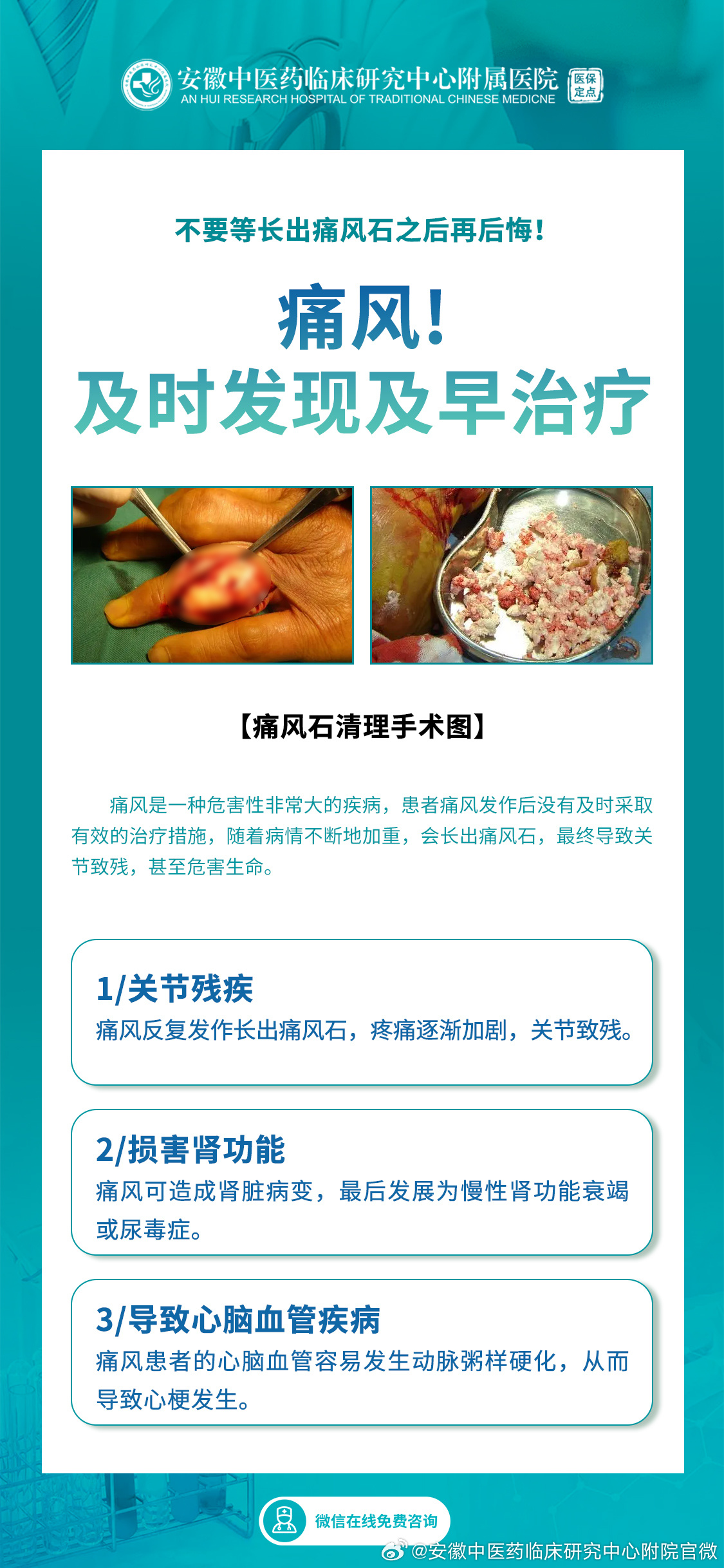 痛风最新治疗进展及论述